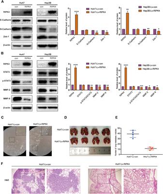 RIPK4 Suppresses the Invasion and Metastasis of Hepatocellular Carcinoma by Inhibiting the Phosphorylation of STAT3